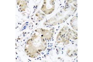 Immunohistochemistry of paraffin-embedded human stomach using PCBP1 antibody at dilution of 1:100 (40x lens). (PCBP1 antibody)