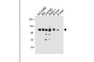 All lanes : Anti-XYLT1 Antibody (N-term) at 1:1000 dilution Lane 1: NCI- whole cell lysate Lane 2: 293 whole cell lysate Lane 3: U-87MG whole cell lysate Lane 4: NC-1 whole cell lysate Lane 5: Mouse brain whole cell lysate Lane 6: Rat brain whole cell lysate Lysates/proteins at 20 μg per lane. (XYLT1 antibody  (N-Term))