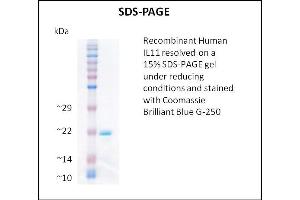 SDS-PAGE (SDS) image for Interleukin 11 (IL11) (Active) protein (ABIN5509338)