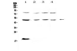 Western Blotting (WB) image for anti-Fc Fragment of IgG, High Affinity Ia, Receptor (CD64) (FCGR1A) (AA 16-292) antibody (ABIN5693206)