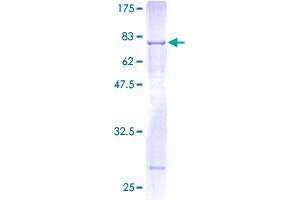 Image no. 1 for Bone Morphogenetic Protein 10 (BMP10) (AA 1-424) protein (GST tag) (ABIN1346746) (BMP10 Protein (AA 1-424) (GST tag))