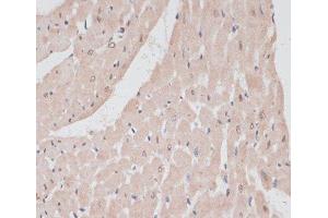 Immunohistochemistry of paraffin-embedded Rat heart using PRPF31 Polyclonal Antibody at dilution of 1:100 (40x lens).