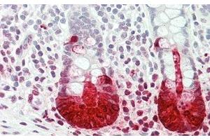 Detection of REG3a in Human Small Intestine Tissue using Monoclonal Antibody to Regenerating Islet Derived Protein 3 Alpha (REG3a) (REG3A antibody  (AA 40-164))