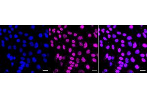 Immunocytochemical staining of HepG2 cells with DGCR8 antibody (ABIN7798333), 1:1,000).
