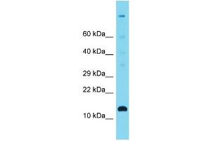 Host: Rabbit Target Name: C12orf23 Sample Type: Fetal Heart lysates Antibody Dilution: 1. (C12ORF23 antibody  (C-Term))