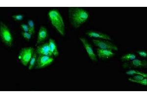 Immunofluorescent analysis of HepG2 cells using ABIN7149738 at dilution of 1:100 and Alexa Fluor 488-congugated AffiniPure Goat Anti-Rabbit IgG(H+L) (DEPDC1B antibody  (AA 343-529))