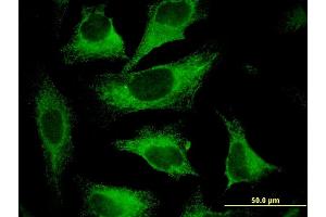 Immunofluorescence of monoclonal antibody to CAST on HeLa cell. (Calpastatin antibody  (AA 582-669))