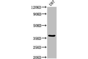 Western Blot Positive WB detected in: U87 whole cell lysate All lanes: GJD2 antibody at 3. (GJD2 antibody  (AA 99-197))