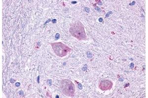 Anti-CHRM4 antibody  ABIN1048444 IHC staining of human brain, neurons and glia. (CHRM4 antibody  (Cytoplasmic Domain))