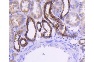 Paraformaldehyde-fixed, paraffin embedded Human kidney, Antigen retrieval by boiling in sodium citrate buffer (pH6) for 15min, Block endogenous peroxidase by 3% hydrogen peroxide for 30 minutes, Blocking buffer at 37°C for 20min, Antibody incubation with Cytochrome C (1F10) Monoclonal Antibody  at 1:50 overnight at 4°C, followed by a conjugated secondary and DAB staining. (Cytochrome C antibody)