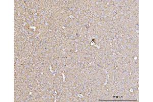 IHC analysis of DBN1 using anti-DBN1 antibody (ABIN7602637).