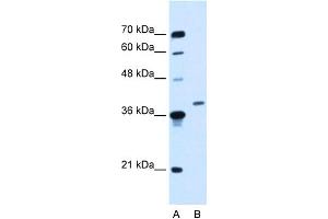 WB Suggested Anti-HOXD11 Antibody Titration:  0. (HOXD11 antibody  (Middle Region))