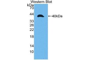 Western Blotting (WB) image for anti-Matrix Metalloproteinase 23A (MMP23A) (AA 71-383) antibody (ABIN1980456) (MMP23A antibody  (AA 71-383))