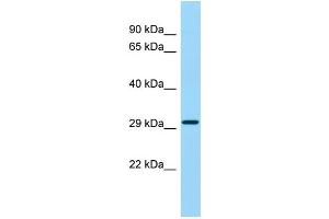 WB Suggested Anti-Asprv1 Antibody Titration: 1.