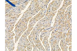 ABIN6265333 and ABIN6278532 at 1/100 staining mouse ovarian tissue by IHC-P.