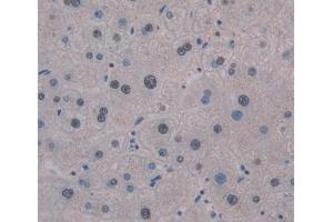 Used in DAB staining on fromalin fixed paraffin- embedded liver tissue (SMUG1 antibody  (AA 1-270))