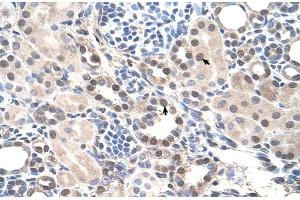 Human kidney (RORA antibody  (Middle Region))