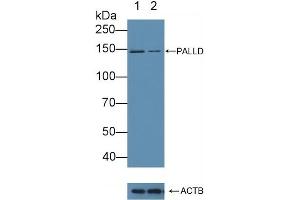 Knockout Varification: Lane 1: Wild-type Hela cell lysate, Lane 2: PALLD knockout Hela cell lysate, Predicted MW: 151,122~127,108kd Observed MW: 145kd Primary Ab: 1 μg/mL Rabbit Anti-Human PALLD Antibody Second Ab: 0. (PALLD antibody  (AA 1137-1383))