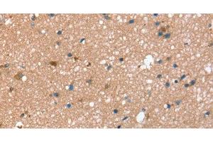 Immunohistochemistry of paraffin-embedded Human brain using STX2 Polyclonal Antibody at dilution of 1:40 (STX2 antibody)