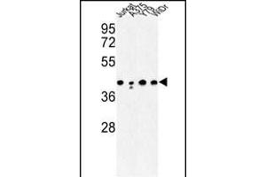 Western blot analysis of CANT1 Antibody (N-term) (ABIN652769 and ABIN2842506) in Jurkat, , Y79, WiDr cell line lysates (35 μg/lane). (CANT1 antibody  (N-Term))