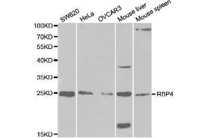 Western blot analysis of extracts of various cell lines, using RBP4 antibody. (RBP4 antibody  (AA 19-201))