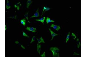 Immunofluorescence staining of SH-SY5Y cells with ABIN7170227 at 1:166, counter-stained with DAPI. (SLC35D3 antibody  (AA 304-416))