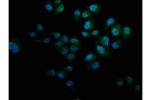 Immunofluorescence staining of Hela cells with ABIN7157376 at 1:133, counter-stained with DAPI. (KRT12 antibody  (AA 1-178))
