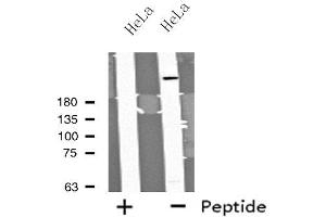 Western blot analysis of extracts from HeLa cells using MYO9B antibody. (MYO9B antibody  (N-Term))
