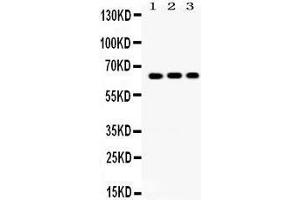 Western Blotting (WB) image for anti-Cryptochrome 1 (Photolyase-Like) (CRY1) (AA 153-189), (N-Term) antibody (ABIN3042761) (CRY1 antibody  (N-Term))