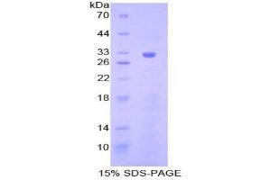 SDS-PAGE analysis of Mouse Janus Kinase 1 Protein. (JAK1 Protein)