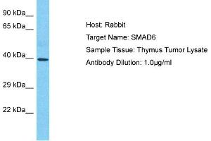 Host: Rabbit Target Name: SMAD6 Sample Type: Thymus Tumor lysates Antibody Dilution: 1. (SMAD6 antibody  (N-Term))
