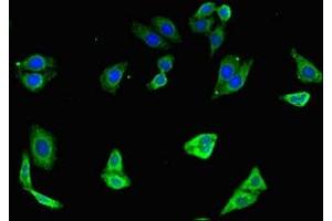 Immunofluorescent analysis of HepG2 cells using ABIN7172282 at dilution of 1:100 and Alexa Fluor 488-congugated AffiniPure Goat Anti-Rabbit IgG(H+L) (TLR7 antibody  (AA 899-1022))