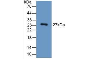 Detection of Recombinant HGD, Mouse using Polyclonal Antibody to Homogentisate-1,2-Dioxygenase (HGD) (HGD antibody  (AA 190-429))