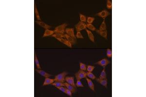Immunofluorescence analysis of NIH-3T3 cells using DCP1A Rabbit mAb (ABIN7266678) at dilution of 1:100 (40x lens). (DCP1A antibody)