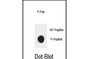 Dot blot analysis of anti-Phospho-ERBB3 (Tyr1289) Antibody Phospho-specific Pab (ABIN1881314 and ABIN2839805) on nitrocellulose membrane. (ERBB3 antibody  (pTyr1289))