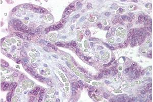 Immunohistochemistry with Placenta tissue at an antibody concentration of 5µg/ml using anti-IRF6 antibody (ARP31995_P050) (IRF6 antibody  (Middle Region))