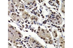 Immunohistochemistry of paraffin-embedded Human stomach using DNAJB6 Polyclonal Antibody at dilution of 1:100 (40x lens).