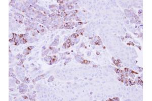 IHC-P Image Immunohistochemical analysis of paraffin-embedded SG xenograft, using Epoxide hydrolase 1, antibody at 1:500 dilution. (EPHX1 antibody)