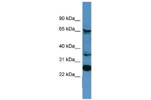 WB Suggested Anti-CANX Antibody Titration: 0. (Calnexin antibody  (C-Term))