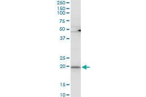 RPL21 polyclonal antibody (A01), Lot # 051220JC01. (RPL21 antibody  (AA 2-85))