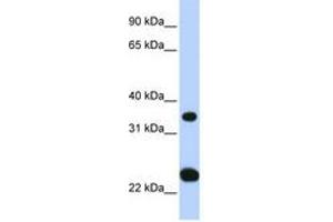 SLC25A35 antibody  (N-Term)