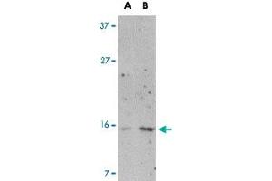 Western blot analysis of NDP in Jurkat cell lysate with NDP polyclonal antibody  at (A) 1 and (B) 2 ug/mL .