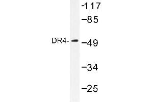 Image no. 1 for anti-Tumor Necrosis Factor Receptor Superfamily, Member 10a (TNFRSF10A) antibody (ABIN272303) (TNFRSF10A antibody)