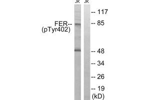 Western blot analysis of extracts from Jurkat cells, treated with starved (24hours), using FER (Phospho-Tyr402) antibody. (FER antibody  (pTyr402))