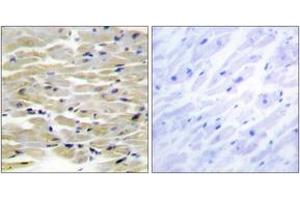 Immunohistochemistry analysis of paraffin-embedded human heart tissue, using TENS3 Antibody. (TNS3 antibody  (AA 541-590))