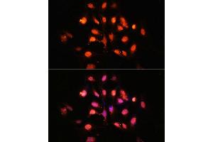 Immunofluorescence analysis of U-2 OS cells using PHLPP1 Polyclonal Antibody (ABIN6128434, ABIN6145573, ABIN6145574 and ABIN6225035) at dilution of 1:100 (40x lens). (PHLPP1 antibody  (AA 1508-1717))