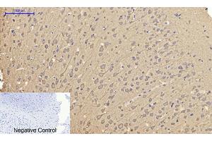 Immunohistochemical analysis of paraffin-embedded rat brain tissue. (Caveolin-1 antibody  (AA 100-180))