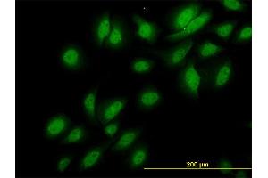 Immunofluorescence of monoclonal antibody to NEK3 on HeLa cell. (NEK3 antibody  (AA 406-506))