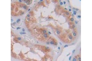 Figure. (CCL17 antibody  (AA 27-94))