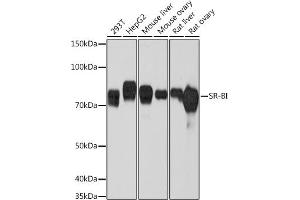 Western blot analysis of extracts of various cell lines, using SR-BI Rabbit mAb (ABIN7270156) at 1:1000 dilution. (SCARB1 antibody)